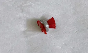 Lấy dị vật trong âm đạo bé 5 tuổi